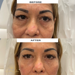 Before & After Treatment Image | Healthy Glow Medical in Orlando, FL